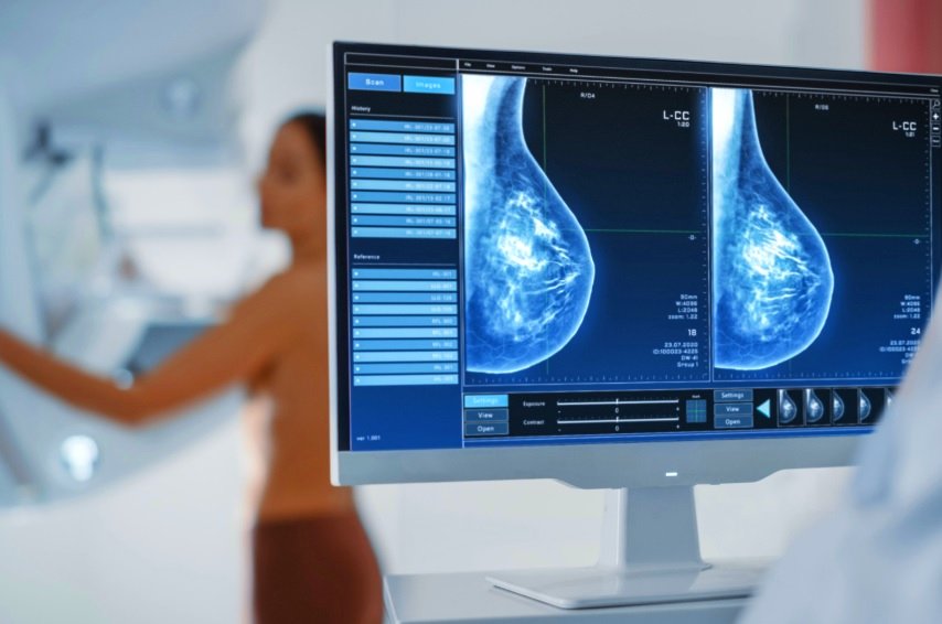 Mulheres em consulta sobre câncer de mama, representando as disparidades entre SUS e rede privada